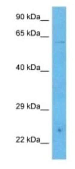 PHACTR3 Rabbit anti-Human, Polyclonal, Novus Biologicals 100 &mu;g | Buy Online | Novus Biologicals | Fisher Scientific